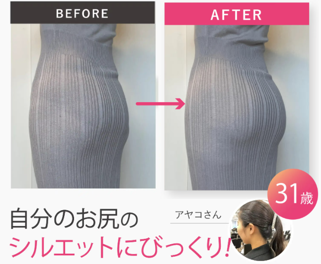 モモフルbeforeafter